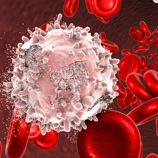 Immunophenotyping by Flow cytometry Leukemia Panel